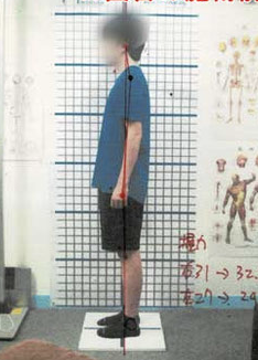 10代男性 After