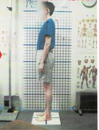 30代男性 After