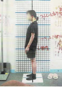 60代女性 Before