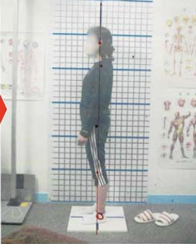 60代女性 After